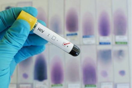 stock-photo-blood-sample-with-hiv-positive