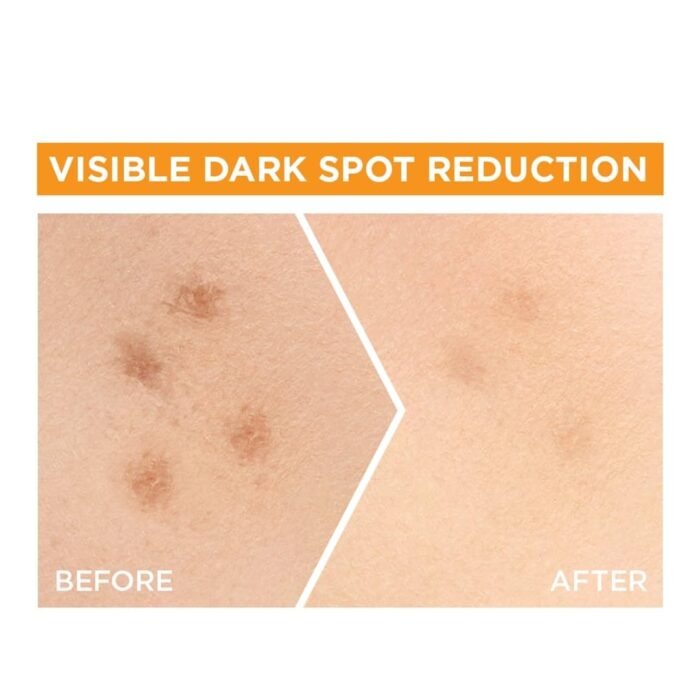 Garnier Skin Naturals, Face Serum