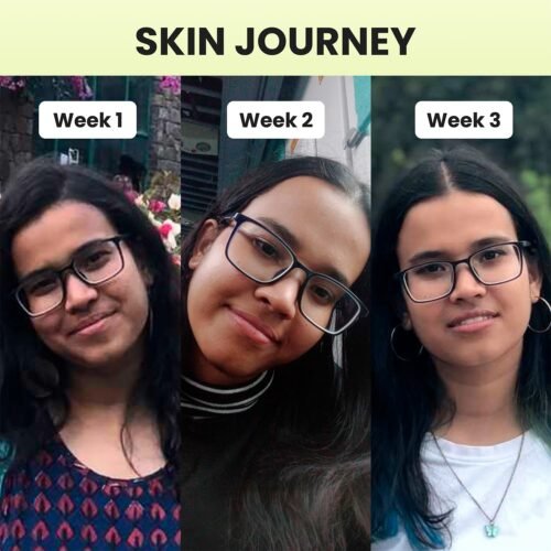 Cos-IQ 20% Niacinamide Face Serum For Clear Glowing Skin, Bright Skin