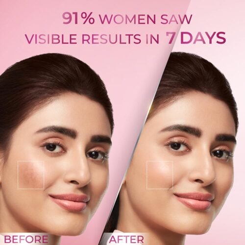 Pond’s Anti-Pigmentation Serum